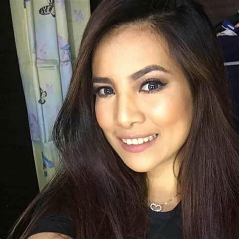 Aila Santos Before Surgery .